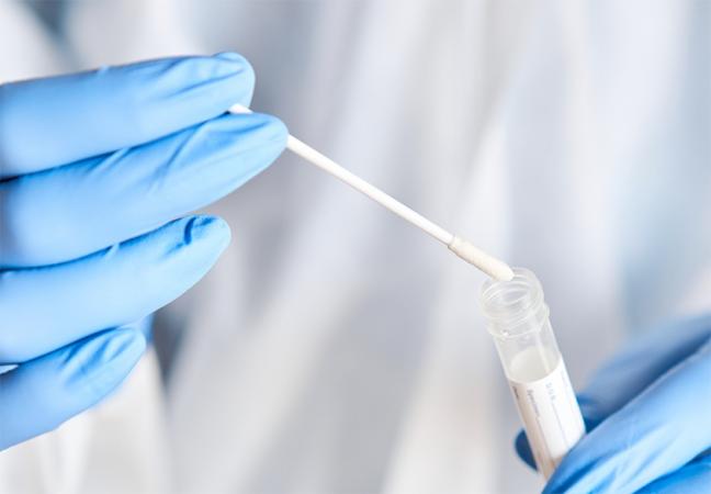 Nagpur Municipal Corporation Resumes RT-PCR Testing for Nagpur